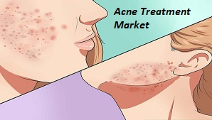 Acne Treatment Market'