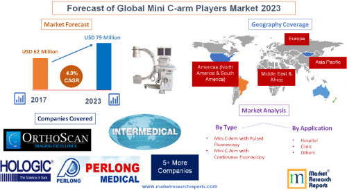 Forecast of Global Mini C-arm Players Market 2023'
