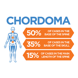 Chordoma Disease Market'