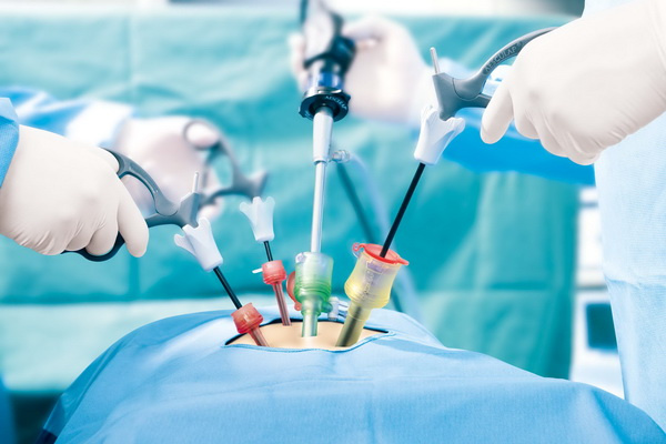 Laparoscopy Devices