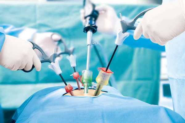 Laparoscopy Devices'