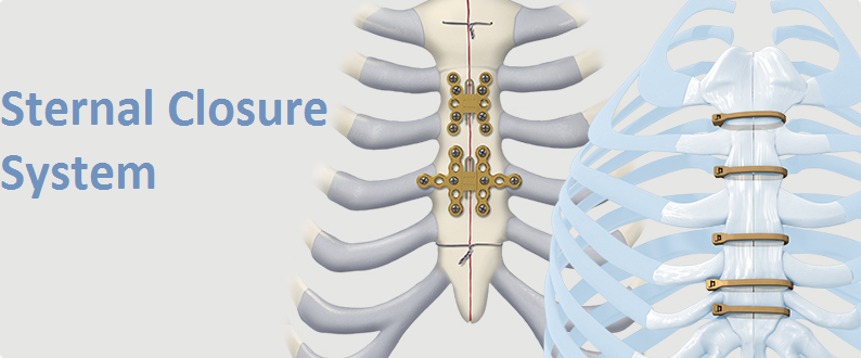 Sternal Closure Systems Market'