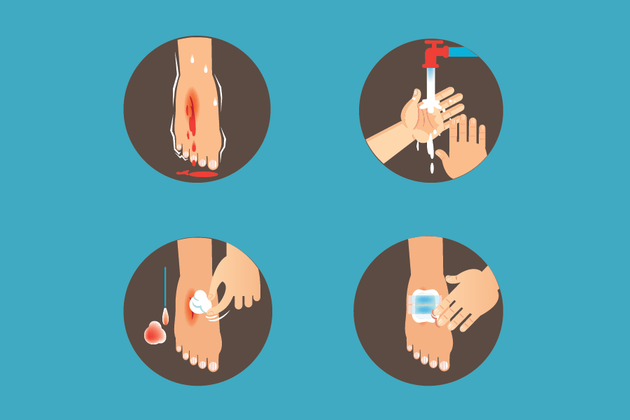 Active Wound Care Market'