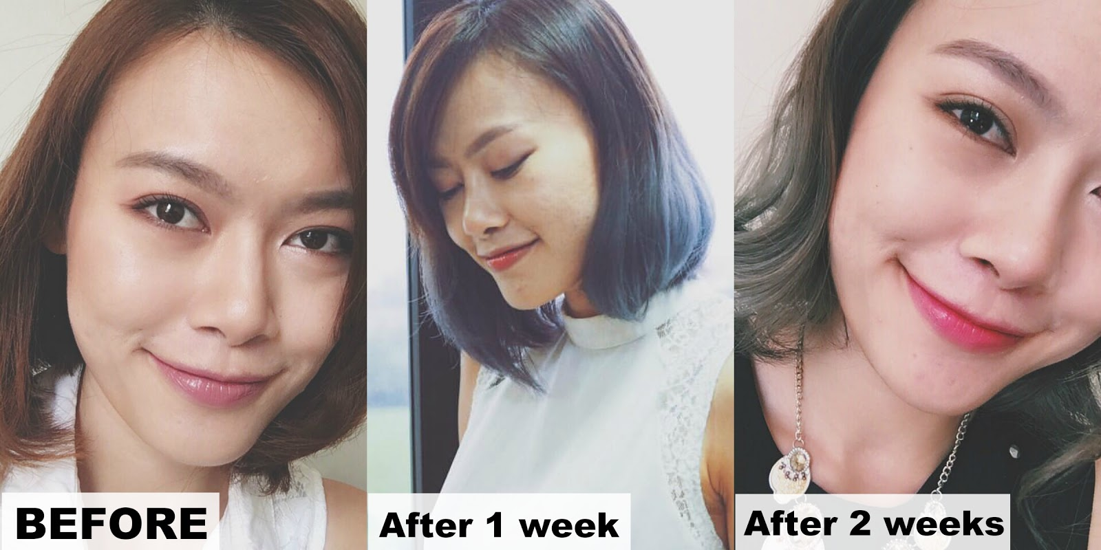 Company Logo For Rhinoplasty cost in Singapore from Rhinopla'