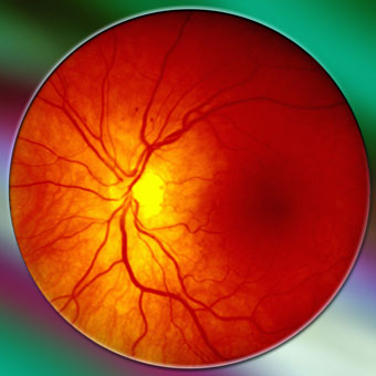 Peripheral Vascular Devices Market to 2018'