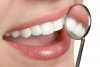 Choosing The Right Dentist'