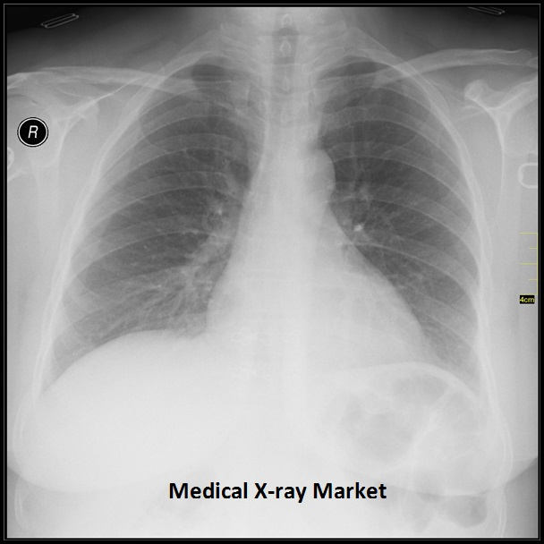 Medical X-ray Market