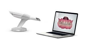 Intraoral Scanners'