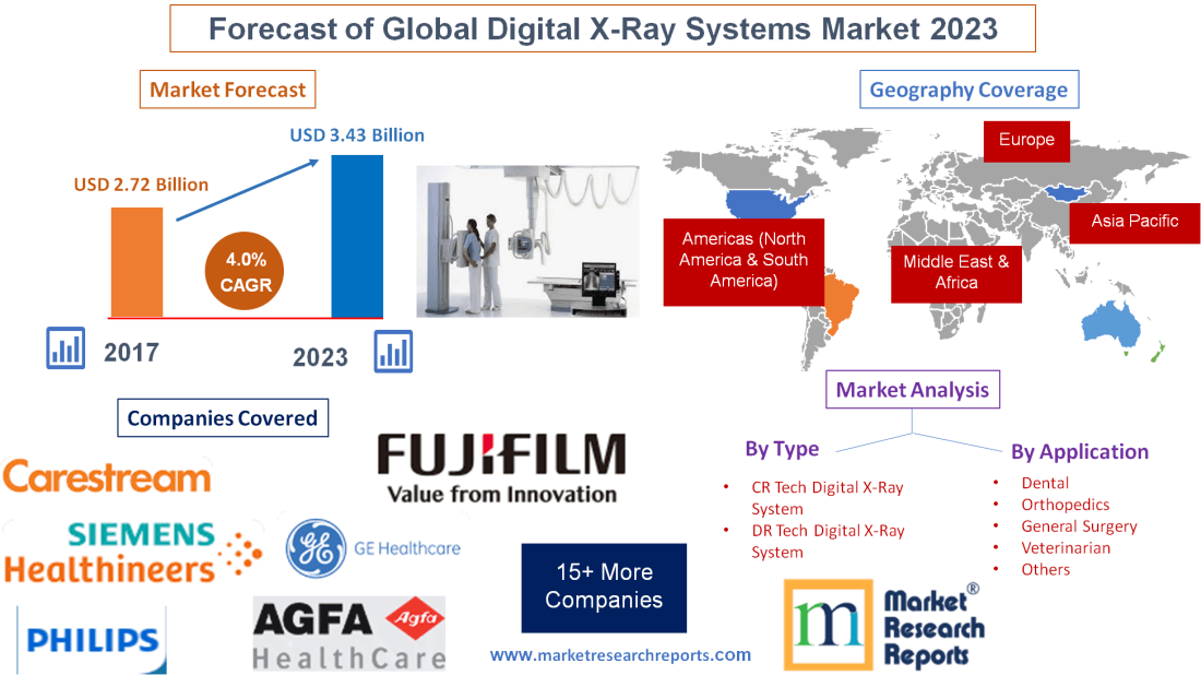 Forecast of Global Digital X-Ray Systems Market 2023'