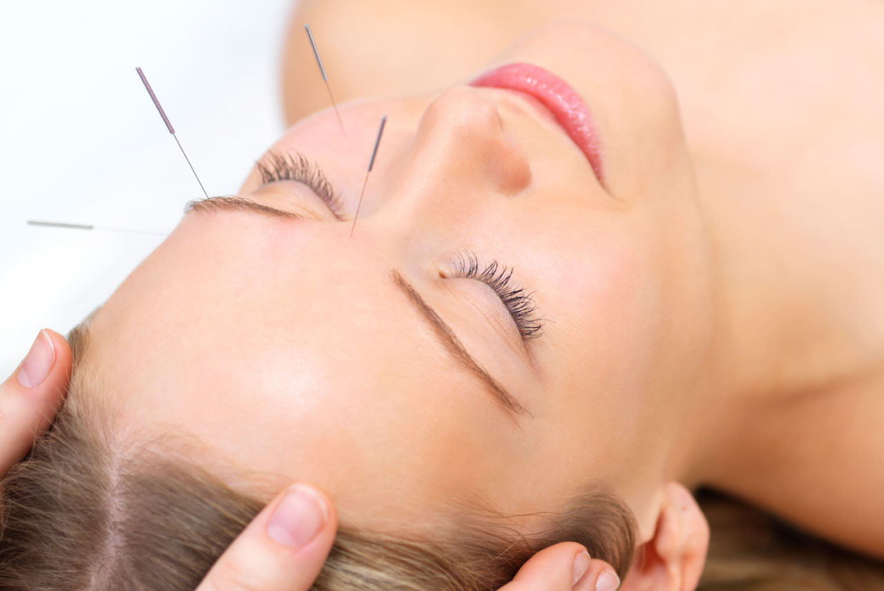 Dry Needling Brisbane'