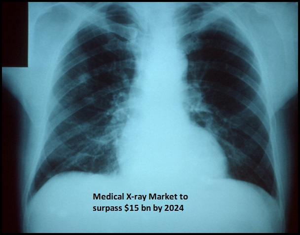 Medical X-ray Market