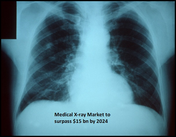 Medical X-ray Market'