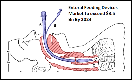 Enteral Feeding Devices Market to exceed $3.5 Bn By 2024