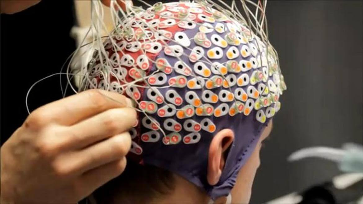 Brain Machine Interfaces Market