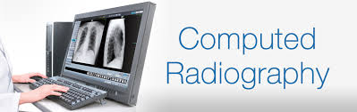 Global Computed Radiography and Digital Radiography Market S'