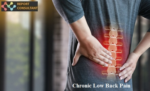 Chronic Low Back Pain Market Is Booming Worldwide'