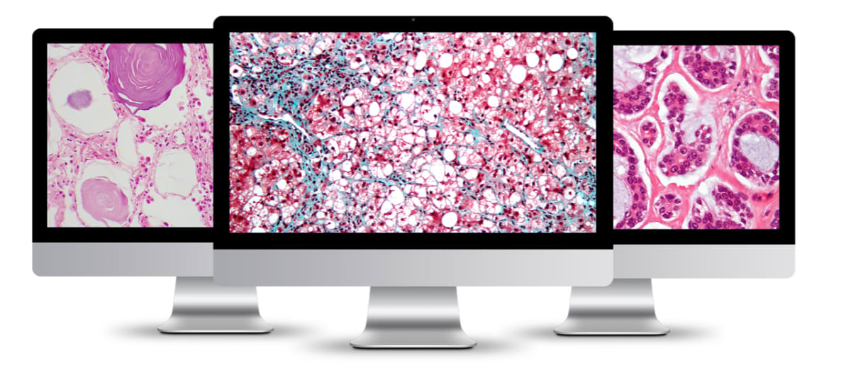 Digital Pathology