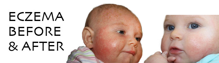 Before and After Photo'