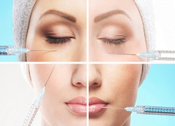 Injectable Fillers Market'