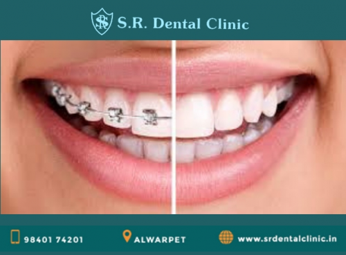 Company Logo For S R Dental Clinic'