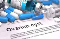 Ovarian Cancer Drugs Market'