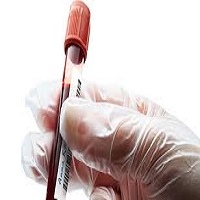 Therapeutic Drug Monitoring
