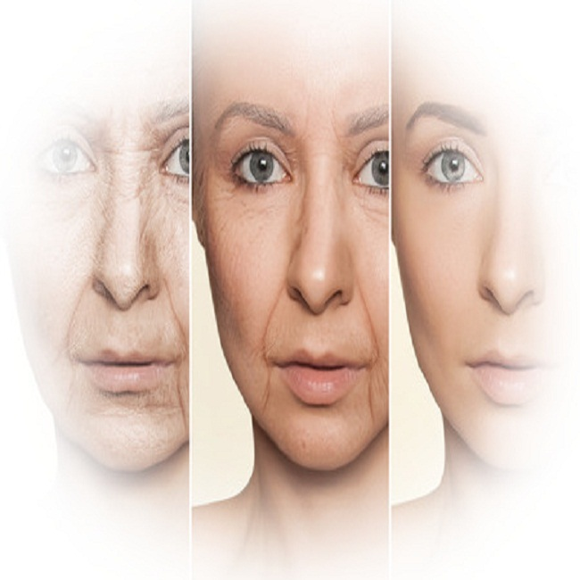 Botox Palm Beach Gardens'