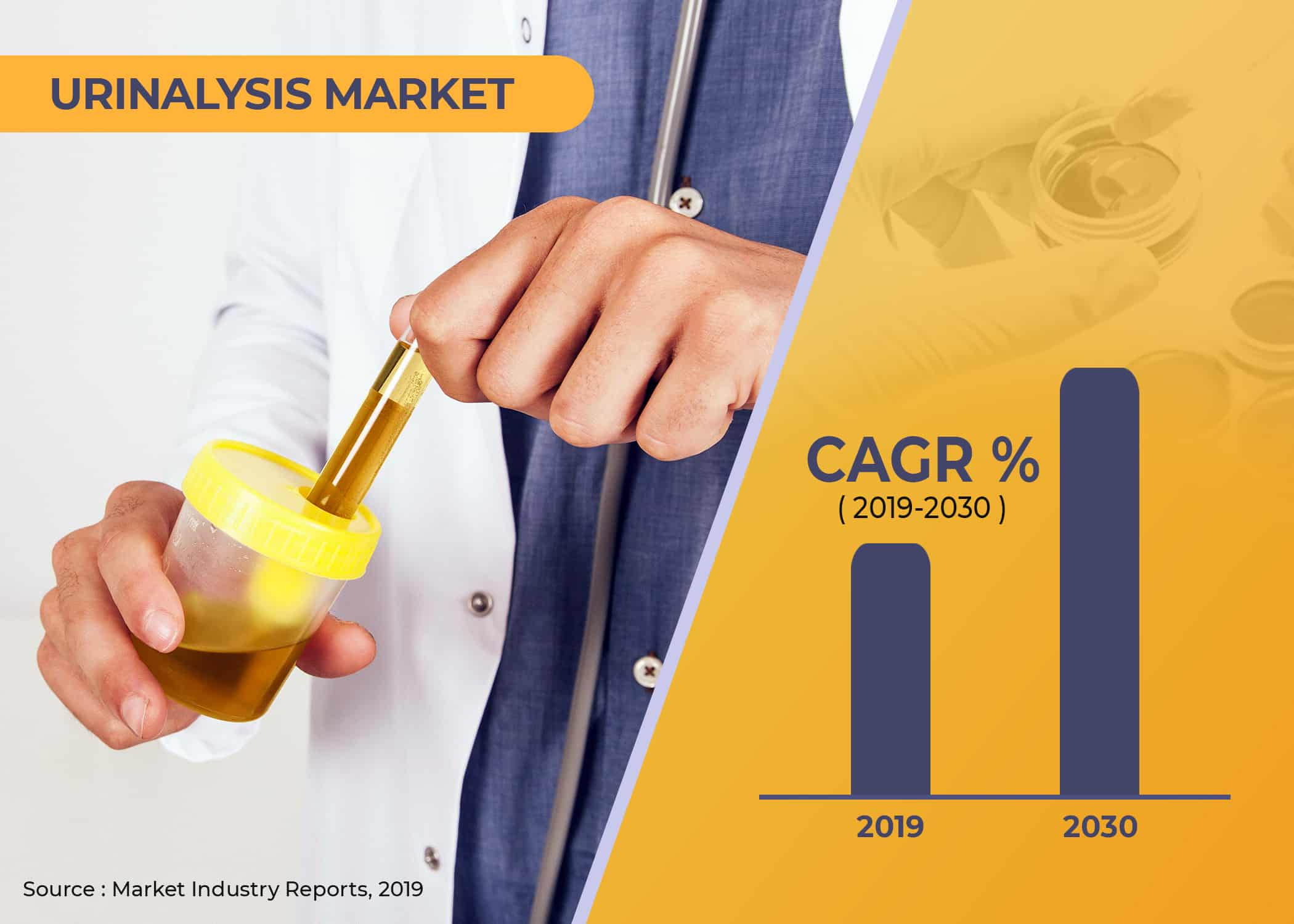 Urinalysis Market'
