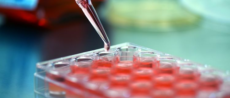 Cell Culture Media Market Research Report 2019
