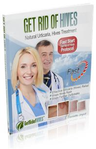 Get Rid of Hives'