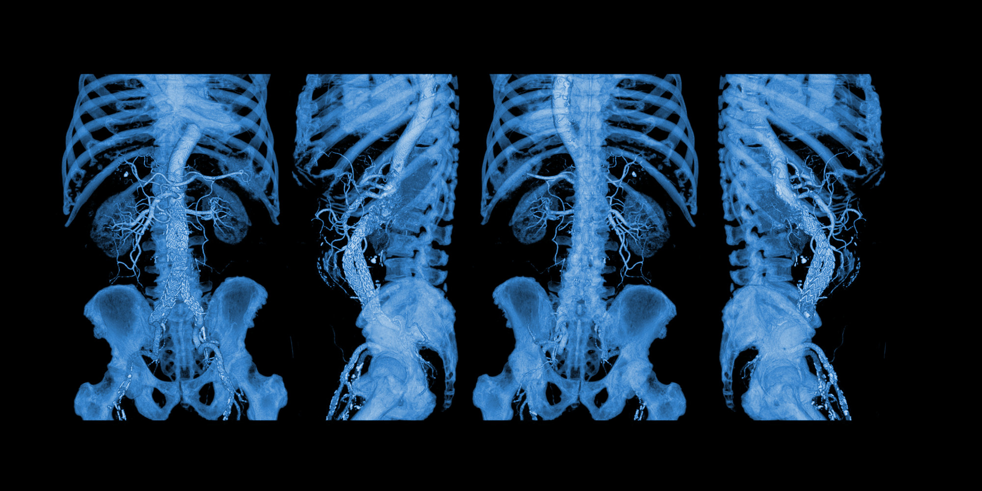 3D Medical Imaging Market'