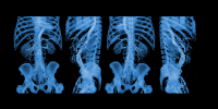 3D Medical Imaging Market