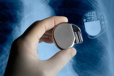 Implantable Medical Device Market