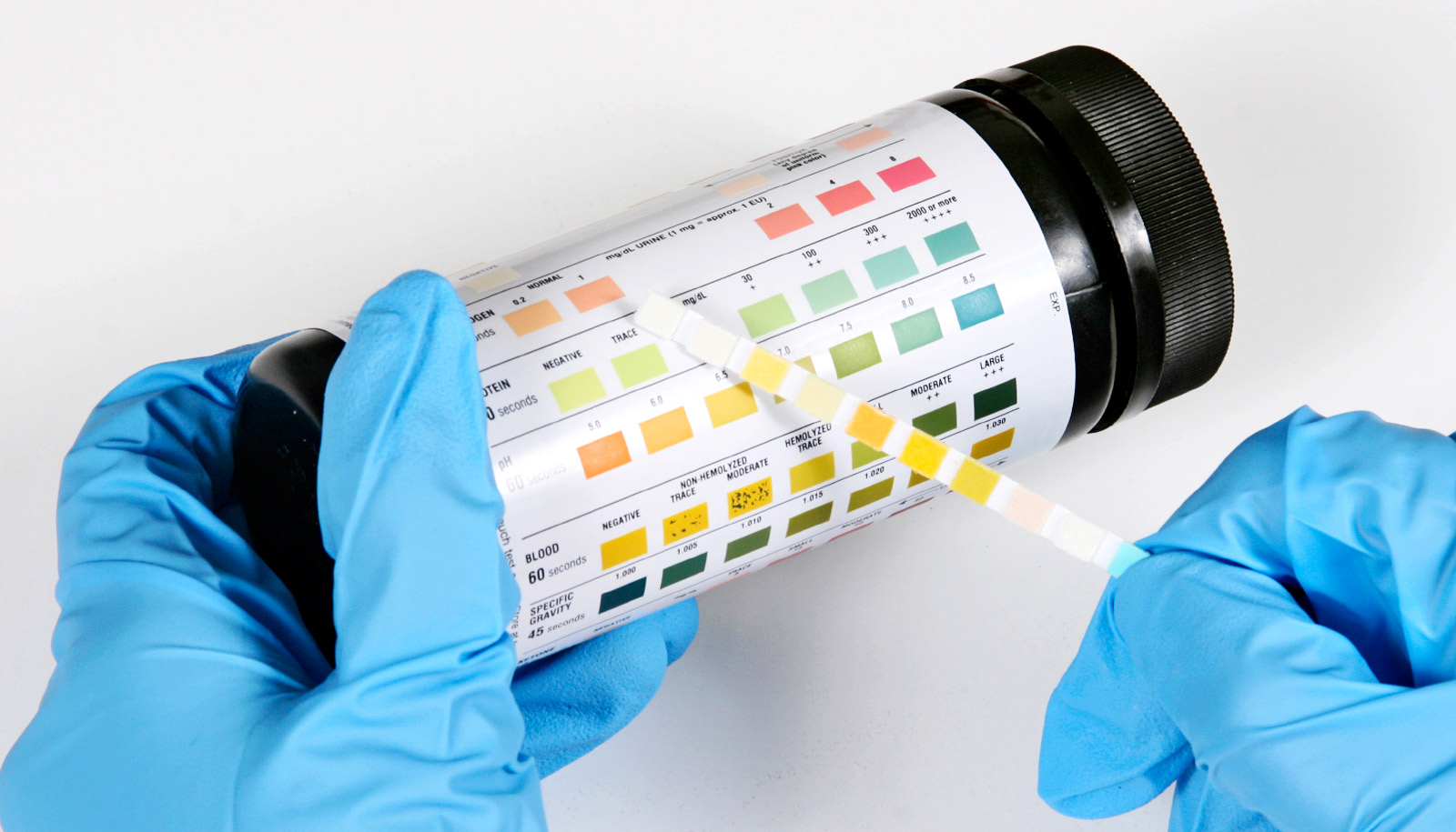 Urinalysis Market'