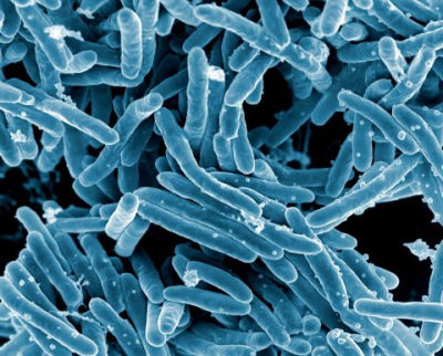 Tuberculosis Diagnostics Market'