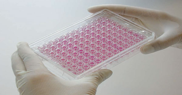 Cell-based Assays Market