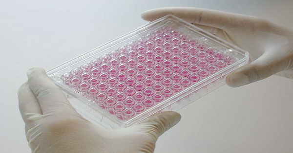 Cell-based Assays Market'