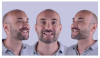 Smile Transformation by Dr Pedro Laranjeira Cosmetic Veneers'