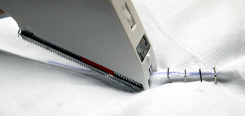 Surgical Stapling Devices Market