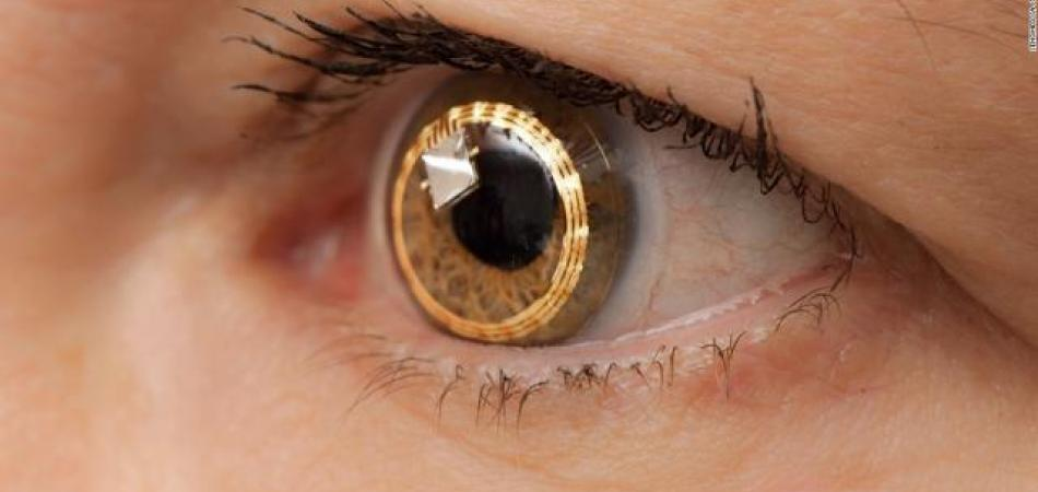 Contact Lenses Market