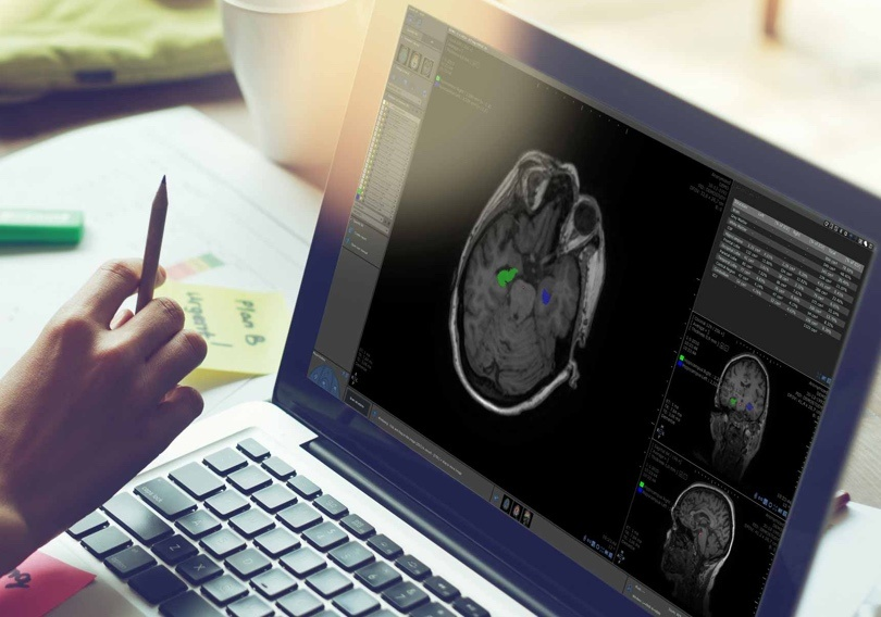 Medical Image Analysis Software Market'