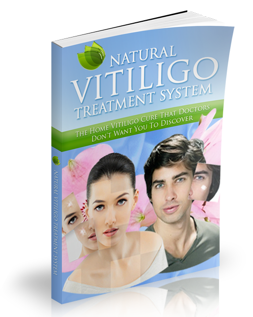 Natural Vitiligo Treatment System'