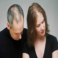Hair Loss Men and Women Market