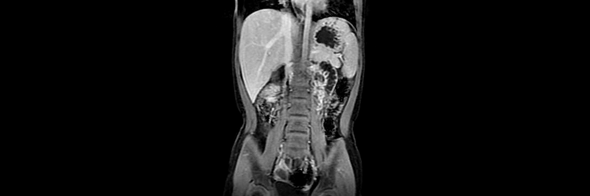 Pediatric Radiology Market