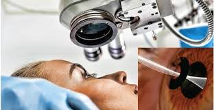 Global Opthalmology Drugs and Devices Market S'