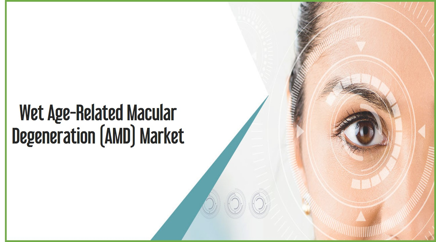 Wet Age-Related Macular Degeneration (AMD) Market