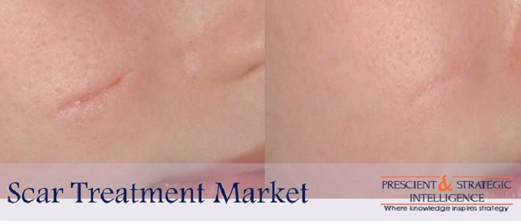 Scar Treatment Market Size 2023'