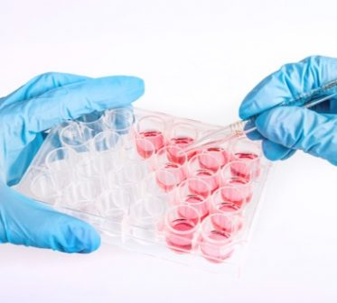 Pyrogen Testing Market