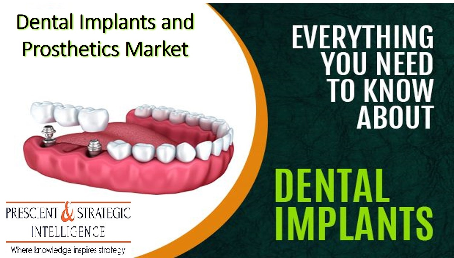 Dental Implants and Prostheses Market