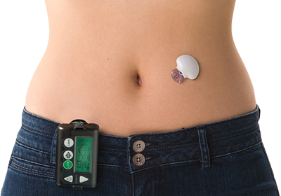 Continuous Blood Glucose Monitoring Systems Market'